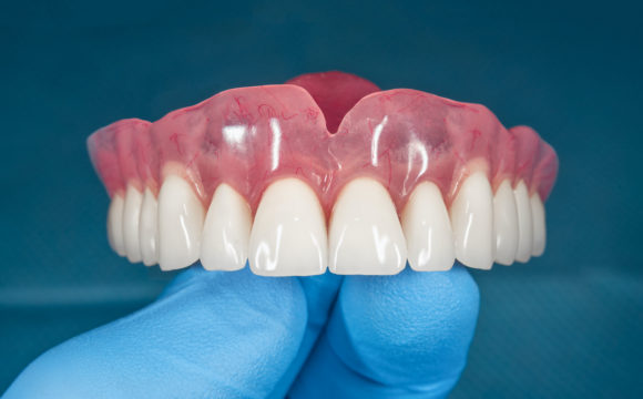 Prótesis y rehabilitación oral